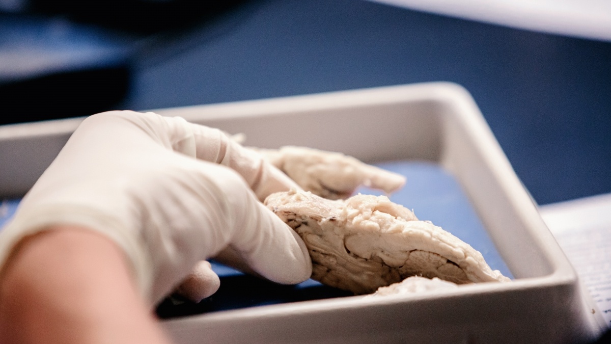A hand holds a specimen 
